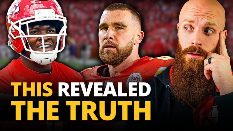 The Chiefs tried to hide this but it&39s even MORE obvious now